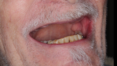 A close up of a man 's mouth with a beard and teeth.