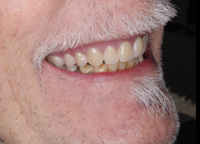 A close up of a man 's mouth with a beard and teeth.