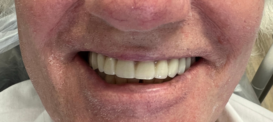 A close up of a person 's face with a smile on it.