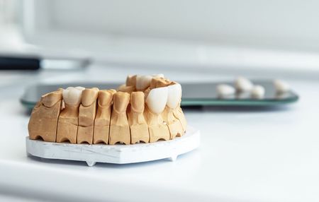 A model of a person 's teeth is sitting on a table.