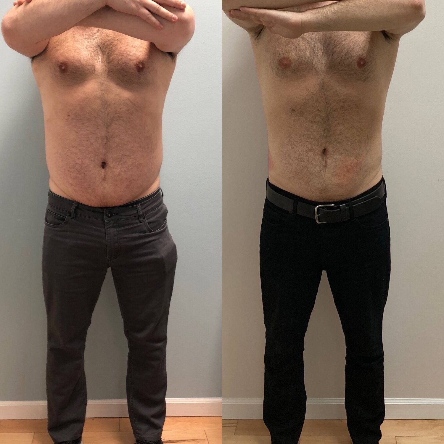 Man before and after photos