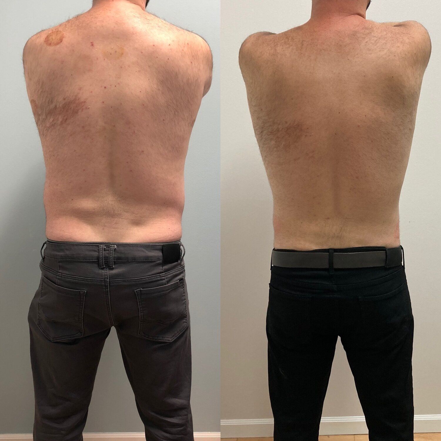 Man before and after photos