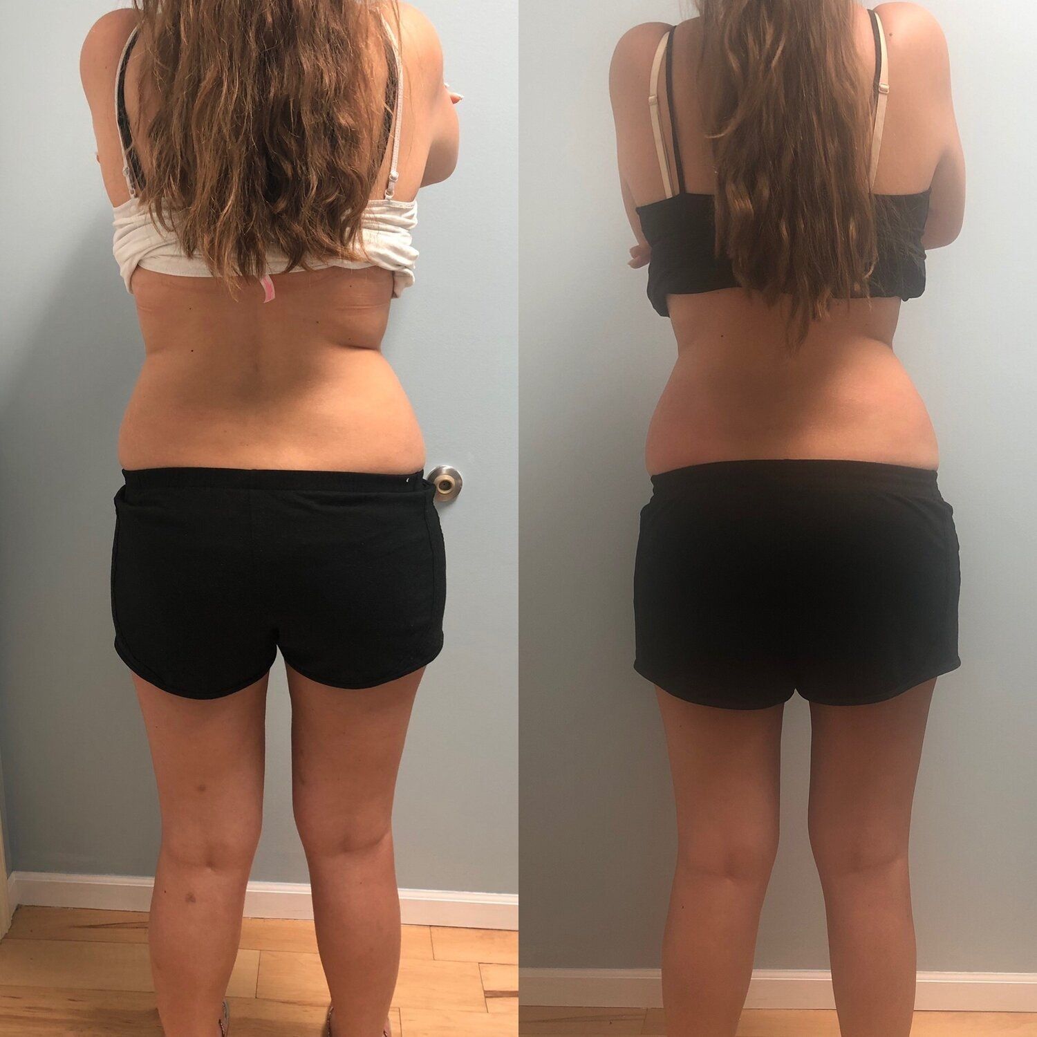 Woman before and after photos