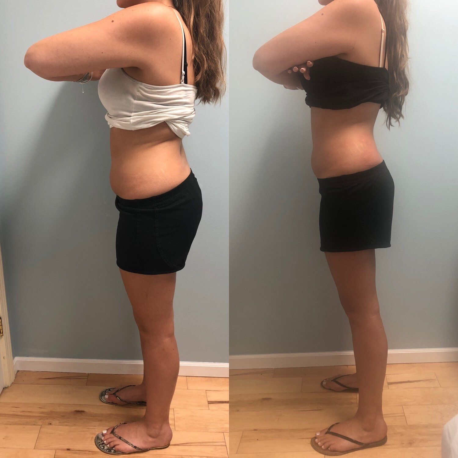 Woman before and after photos