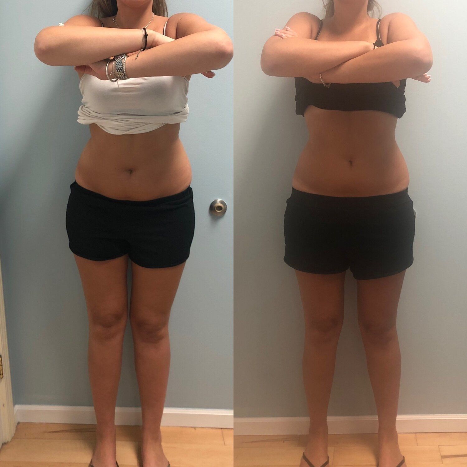 Woman before and after photos