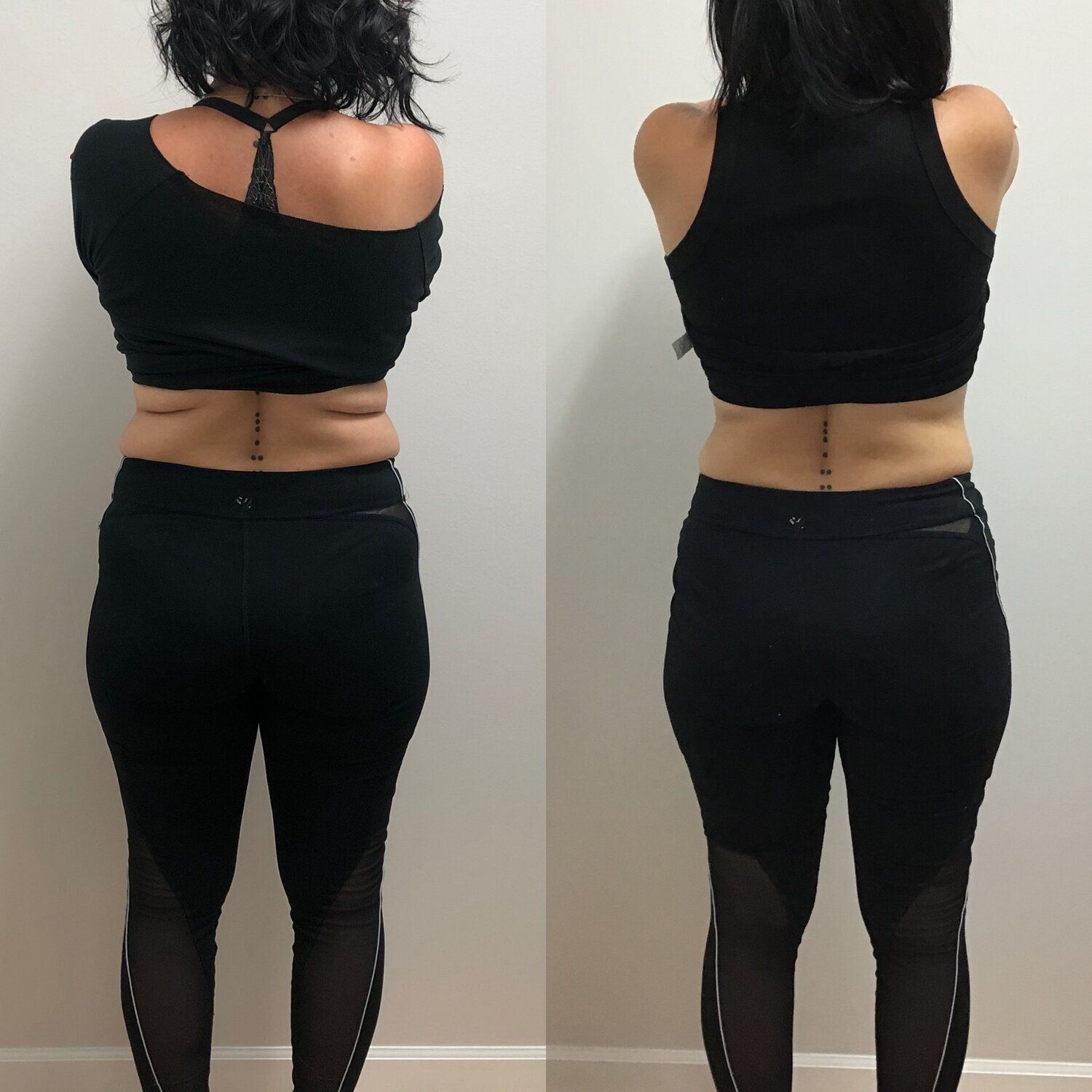 Woman before and after photos