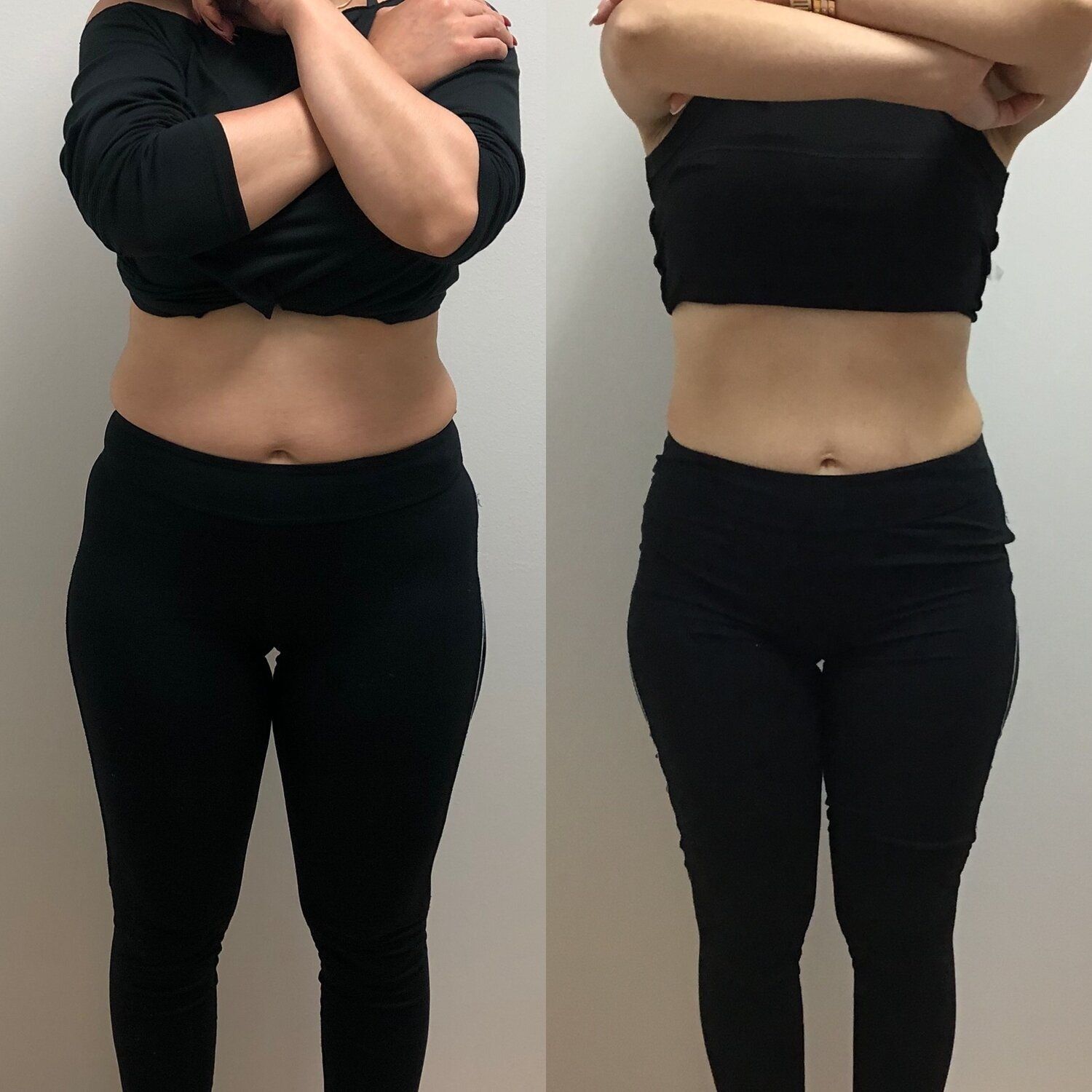 Woman before and after photos