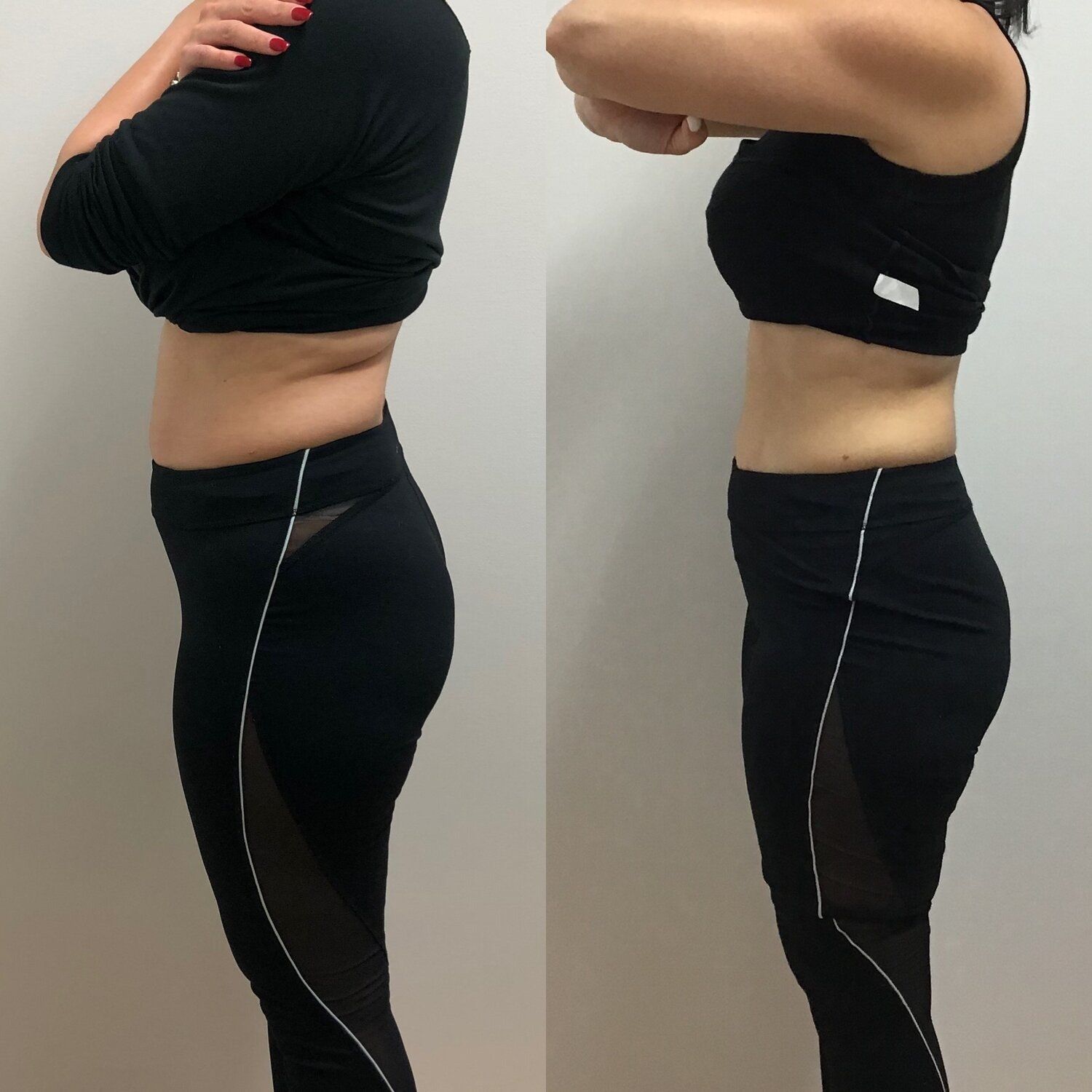 Woman before and after photos