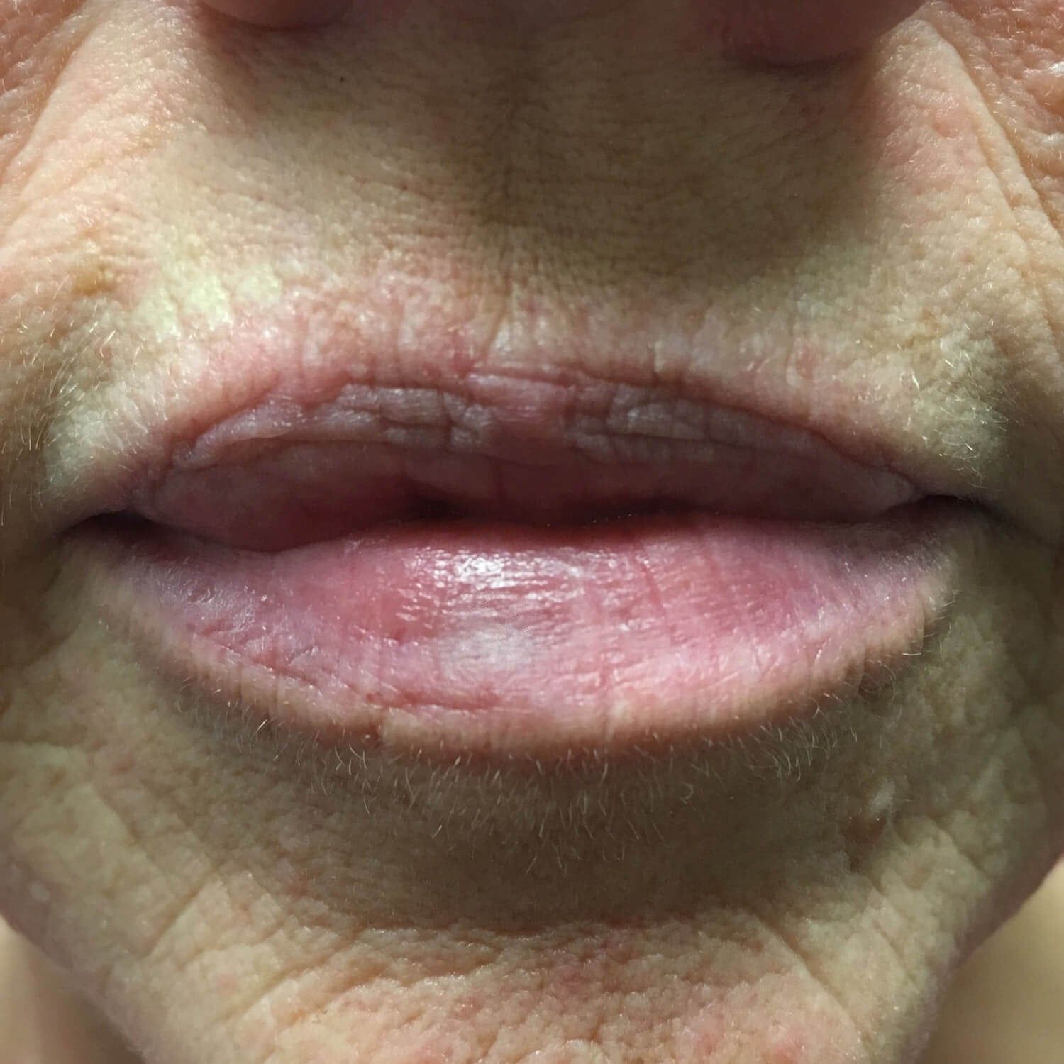 A close-up view of a person's mouth and lips, showing subtle skin texture and coloration.