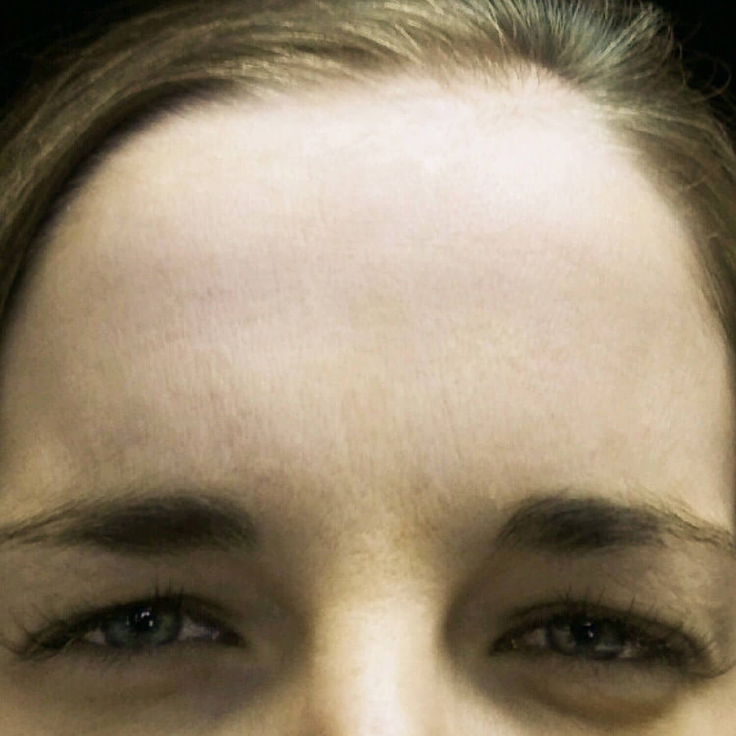 Close-up on a person's upper face, focusing on their forehead and eyes with a neutral expression.