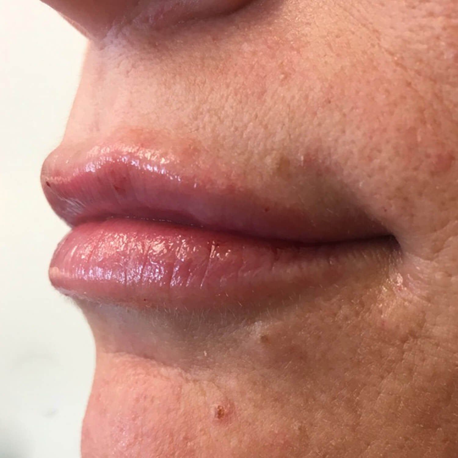 A close-up side view of a person's lips showing natural, pinkish tones and skin texture around the mouth.