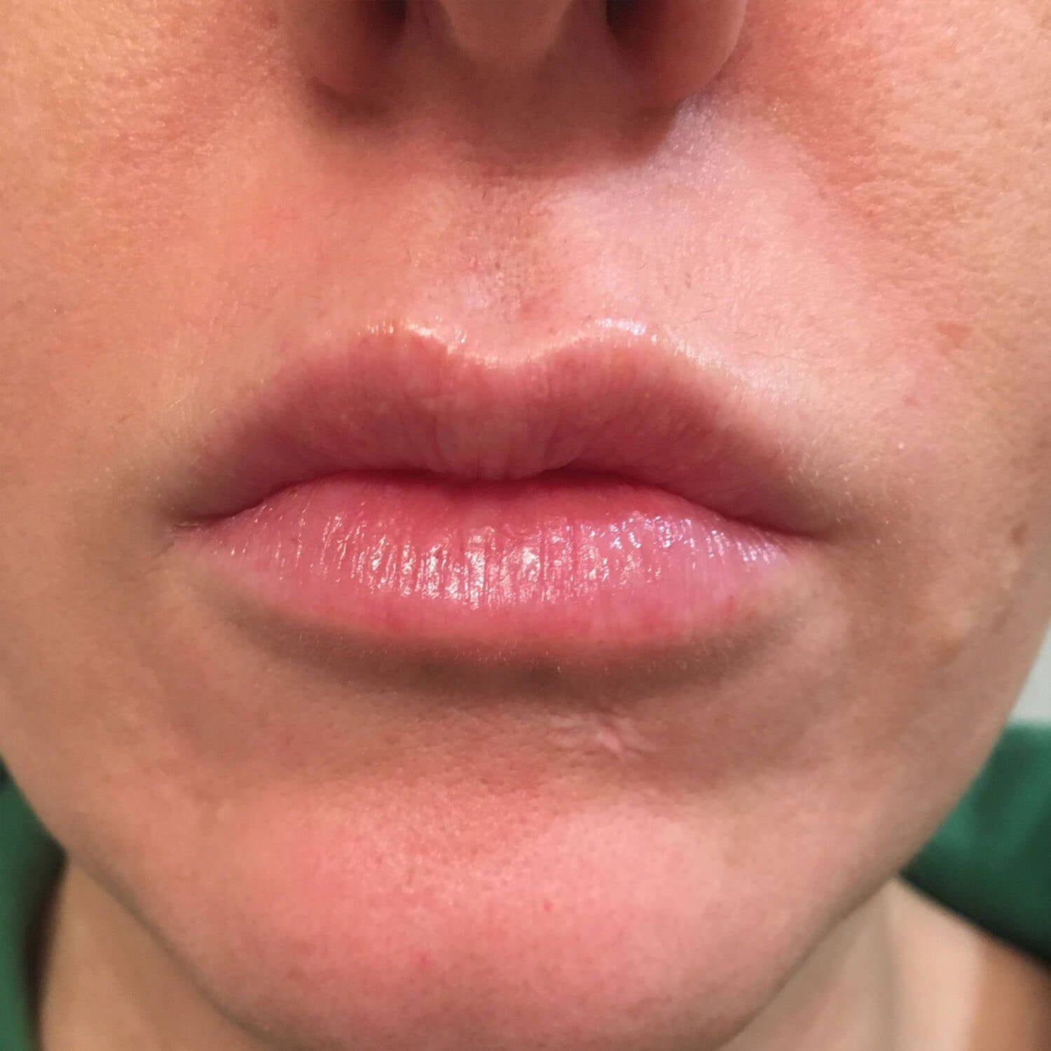 Close-up of a person's mouth and chin, showing light pink, natural lips and smooth skin.