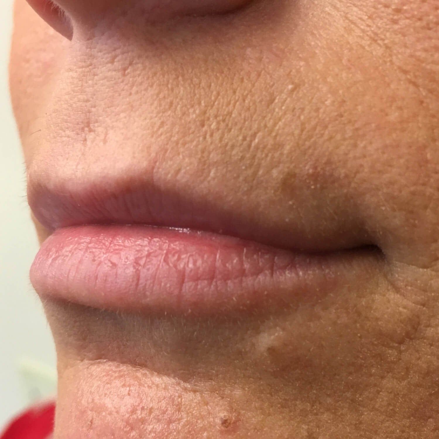 Close-up of a person's mouth and chin, showing skin texture and lips.