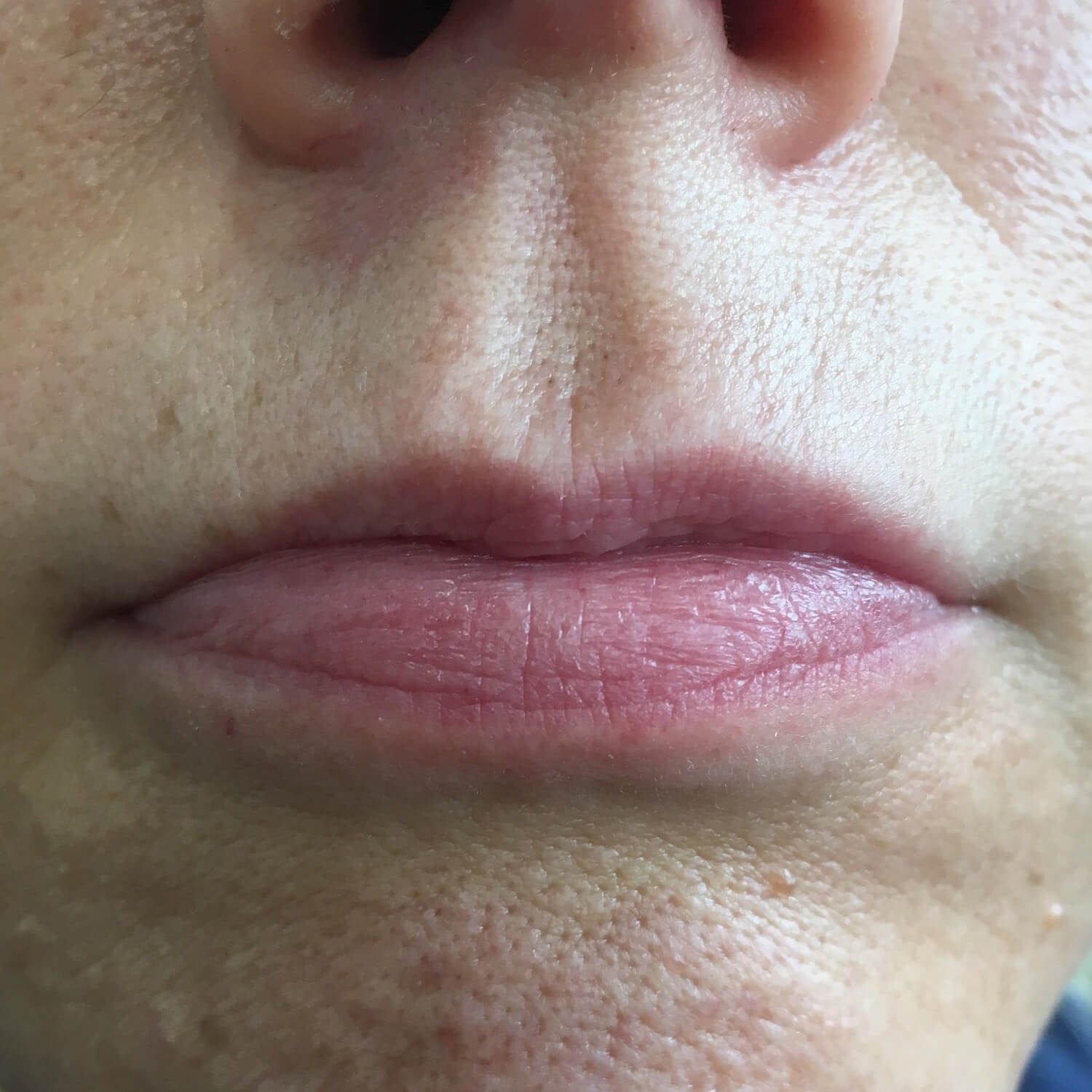 Close-up of a person's mouth and nose, focusing on the texture of the skin and lips.