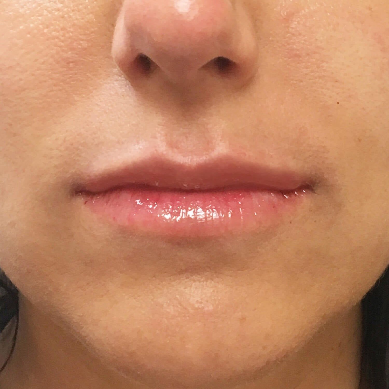 Close-up of a person's mouth and nose, showing natural lips with a glossy finish.