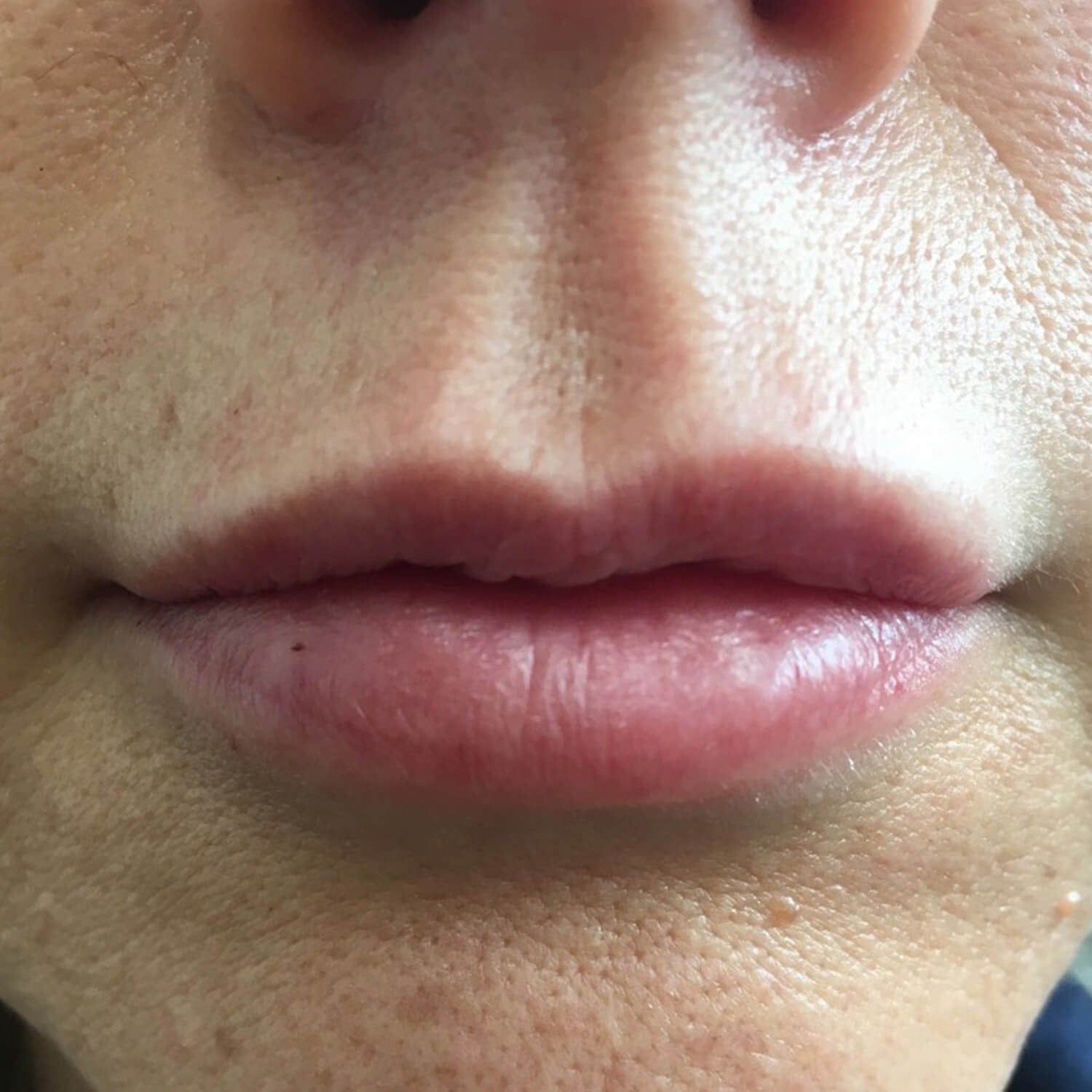 A close-up view of a person's mouth and nose, showing natural skin texture, lips, and the philtrum area.