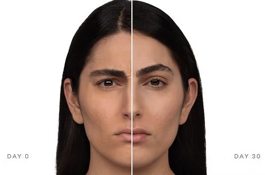 Split-face comparison of a woman before and after 30 days, labeled Day 0 and Day 30.