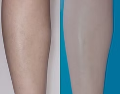 Side-by-side close-up of two lower legs, one with visible hair and one smooth against a blue background