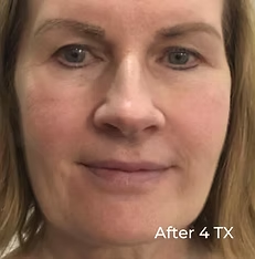 Close-up of a woman’s face with a subtle smile; text reads “After 4 TX”