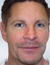 Close-up portrait of a man with short hair and light facial hair, facing the camera with a neutral expression