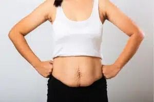 Person in white sports bra and black bottoms with hands on hips, showing a belly fold against a gray background