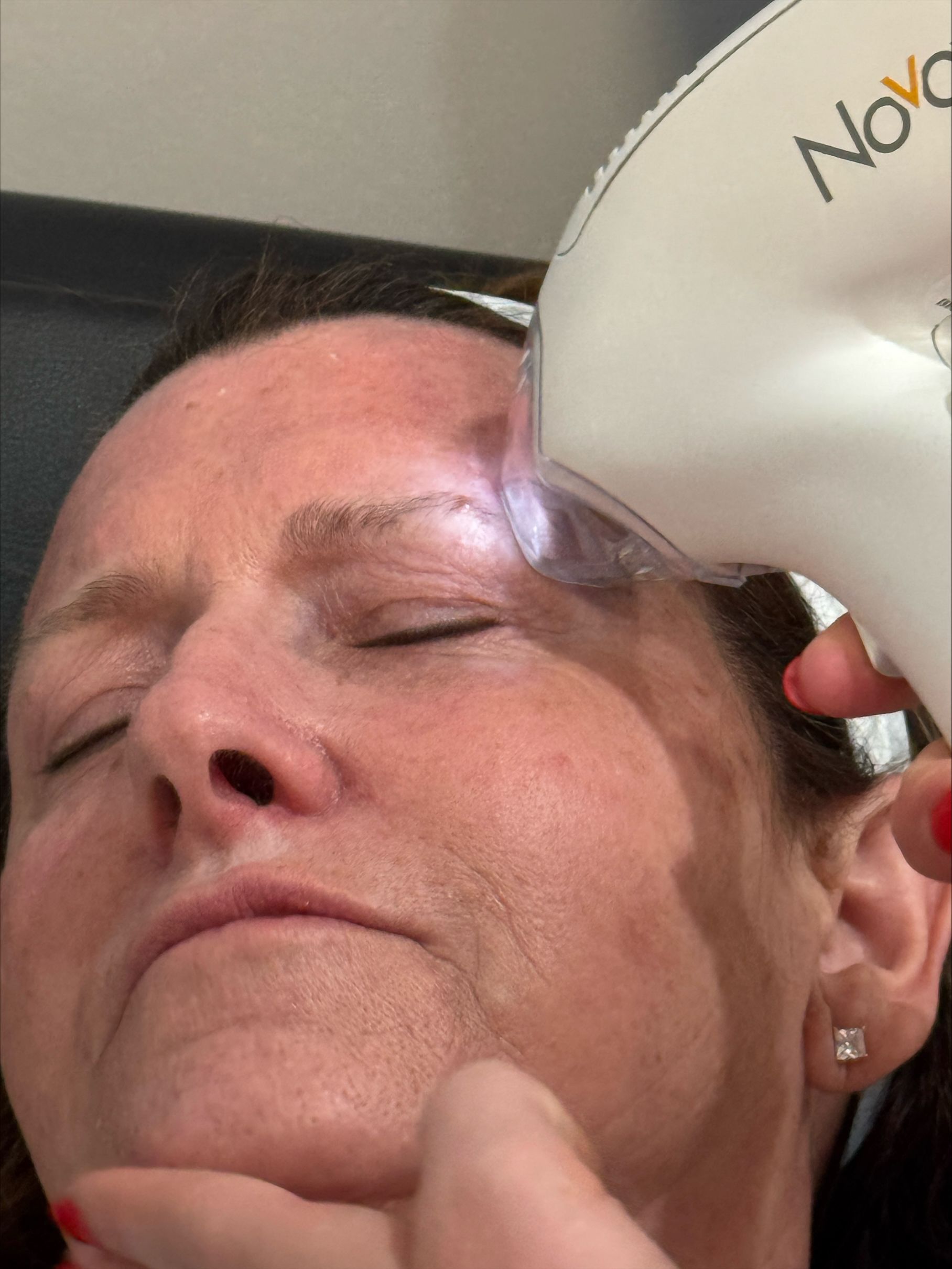 Woman receiving a facial treatment with a handheld device near her temple, eyes closed.