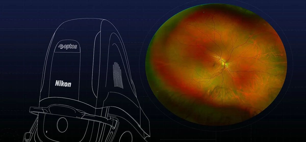 Imaging of a person's eye