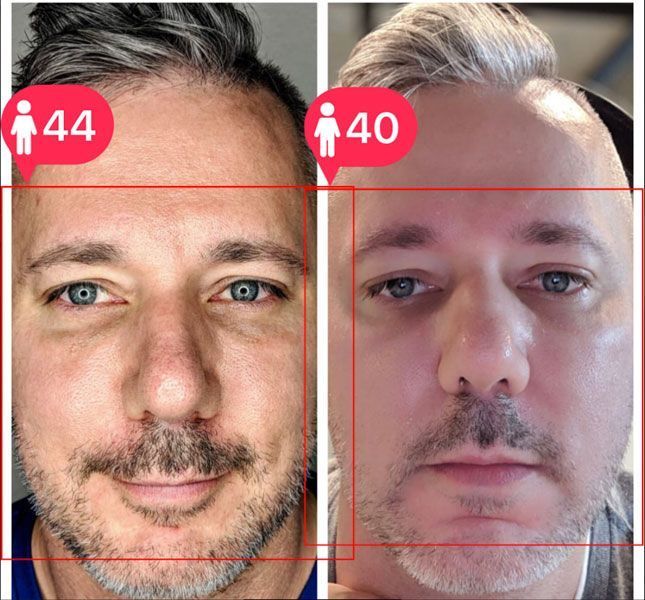 A split-screen comparison of the same face with digital age overlays showing 44 on the left and 40 on the right.