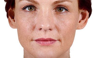 A close-up shot of a person's face with a neutral expression, shown against a plain white background.