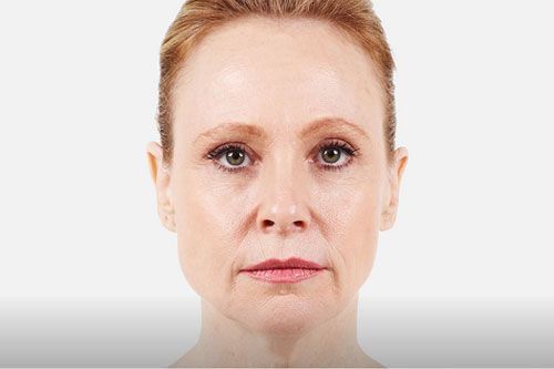 A person facing forward against a neutral background with a calm, neutral expression.