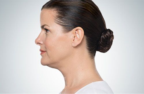 Side profile of a person showing the jawline and neck area against a plain, light gray background.