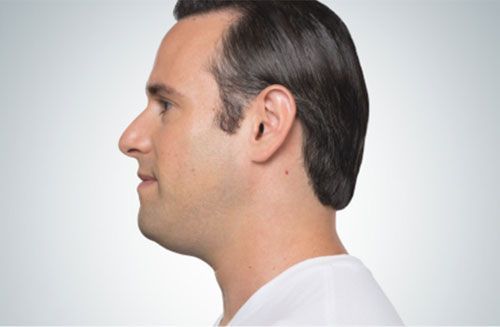 Profile view of a person wearing a white shirt against a light gray background.