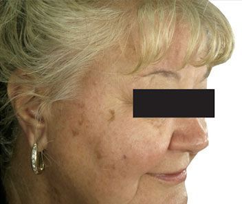 Profile view of a blonde woman with a black bar censoring her eyes