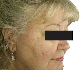 Profile view of a woman with a black bar over her eyes, wearing a dangling earring on a white background