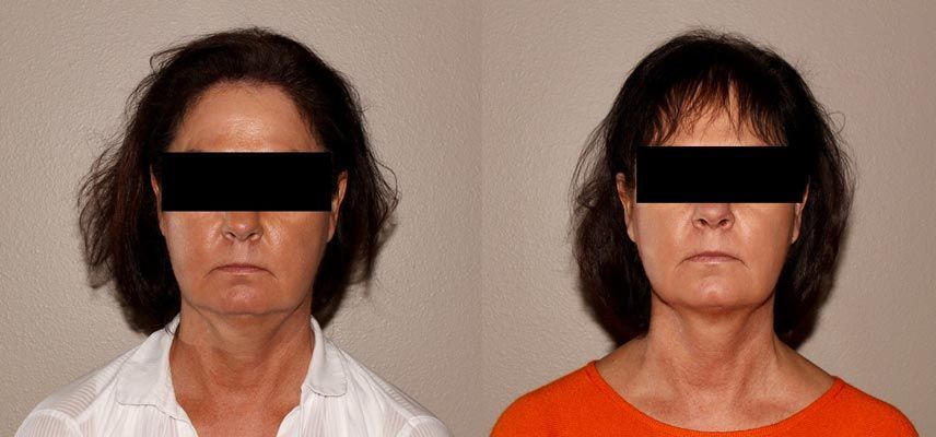 Two side-by-side portrait photos of the same person, one in a white shirt and one in an orange shirt.