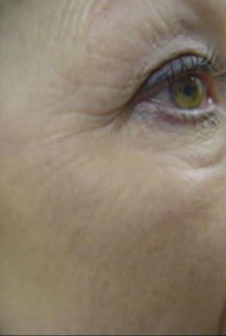 Close-up of a person’s eye and cheek with fine wrinkles, showing a green-brown iris.