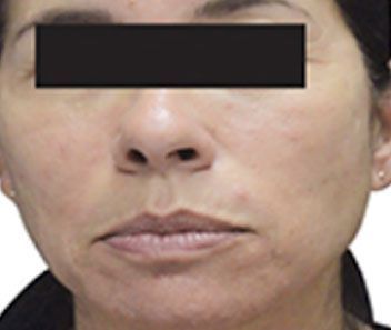 Close-up of a person’s face with a black bar covering the eyes, neutral expression.