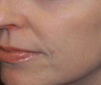 Close-up of a person’s lower face and lips with light pink lipstick