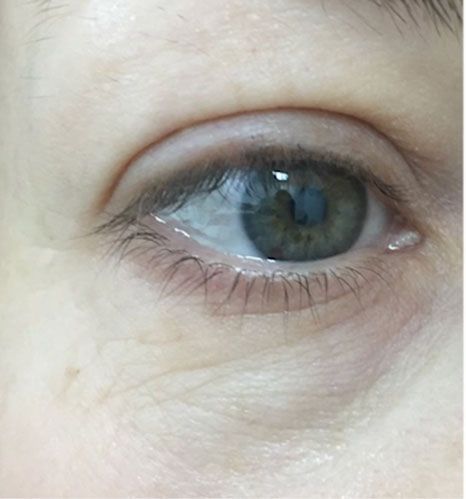 Close-up of a blue-green eye with a light reflection and pale skin surrounding it