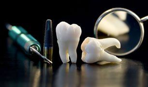 tooth implants