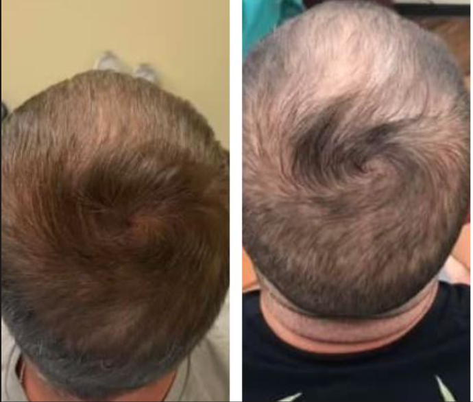 a before and after photo of a man 's hair