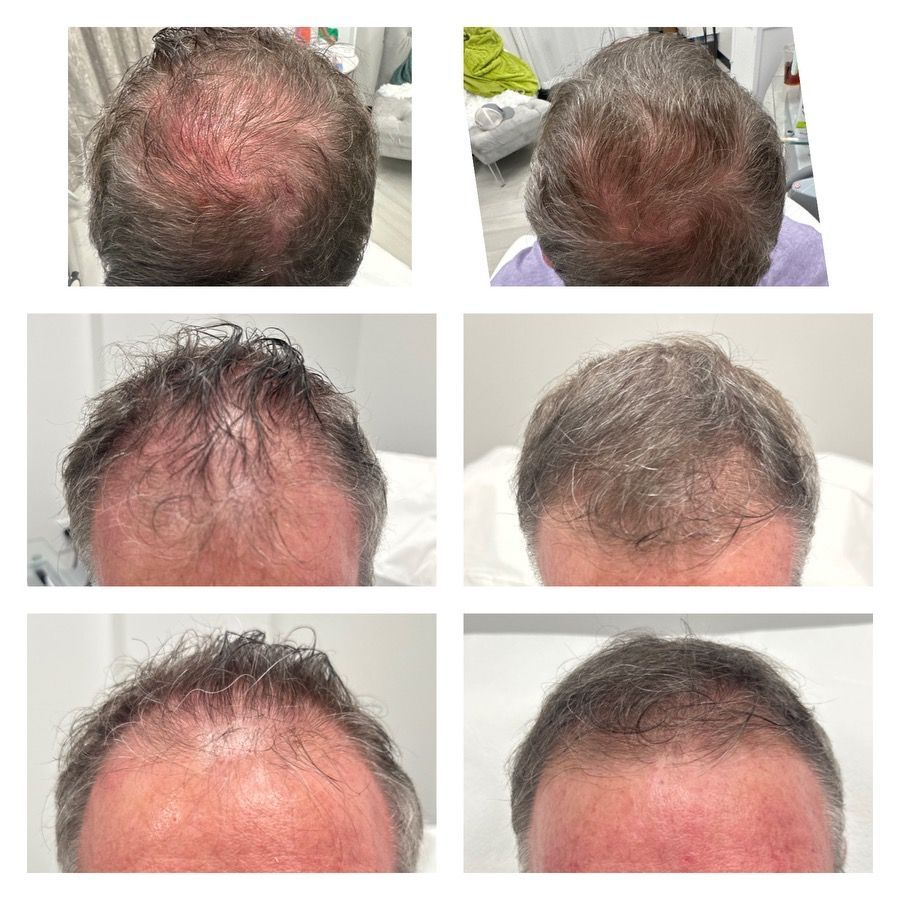 Hair rejuvenation before and after