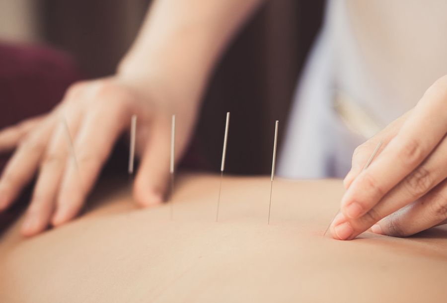 Acupuncture practice