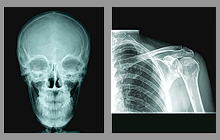 Skull and shoulder x-ray