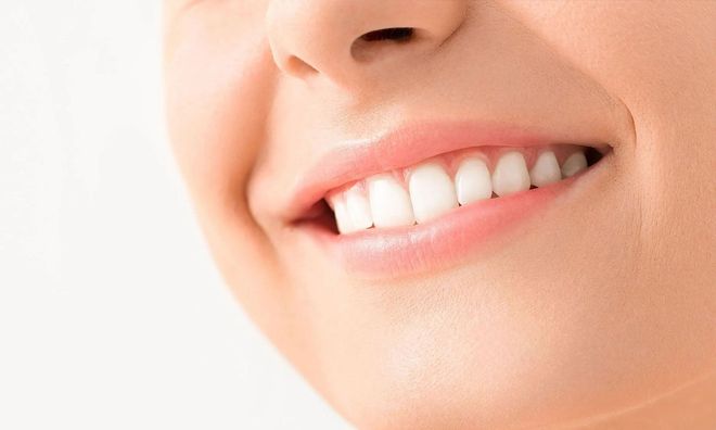 A close up of a woman 's smile with white teeth and pink lips.
