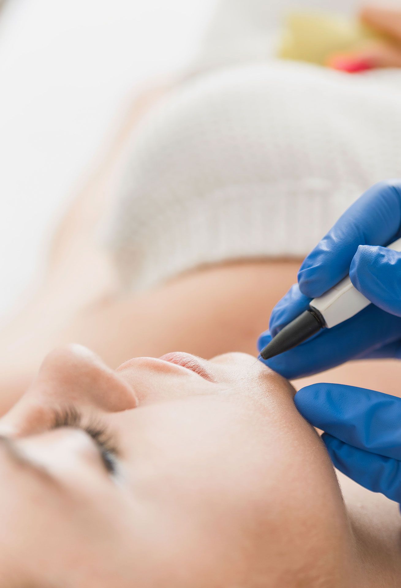 A woman is getting hair removal through needle-based electrolysis