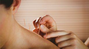 shoulder acupuncture