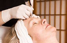 Microdermabrasion