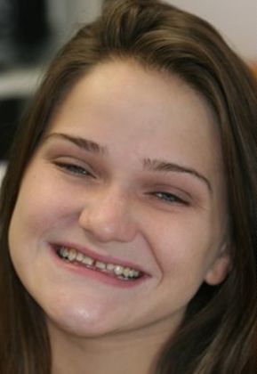 Smiling person with light brown hair, slightly crooked teeth, and a facial expression indicating happiness.