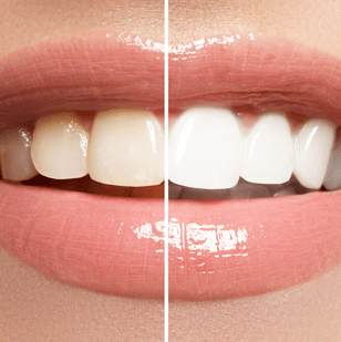 Learn more about Cosmetic Work